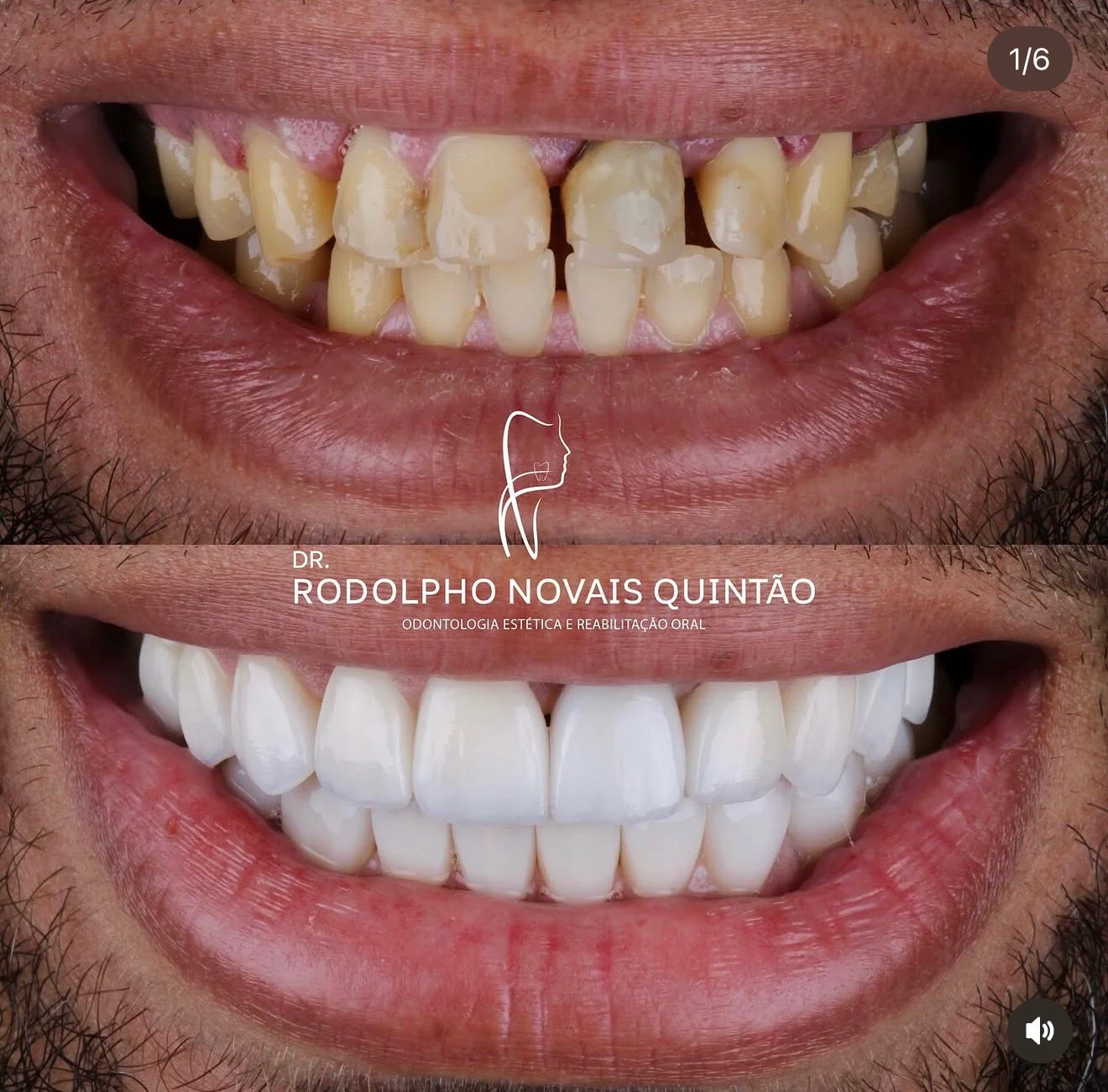 Resultado 7